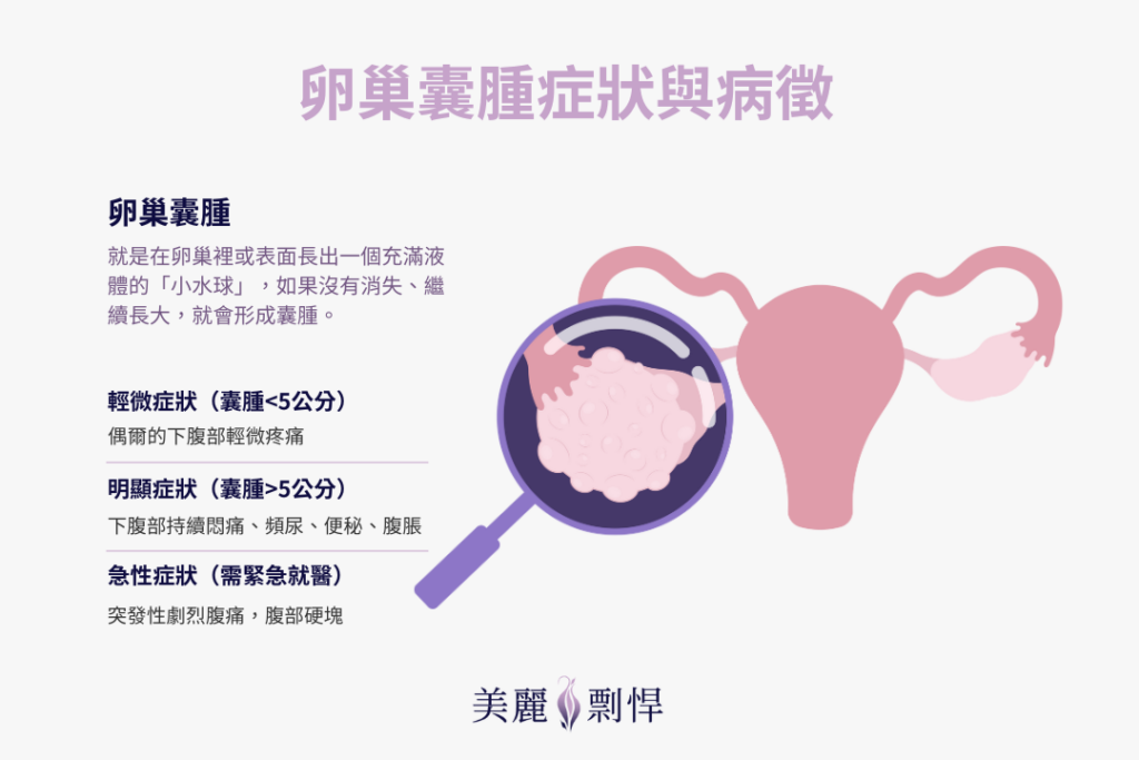 卵巢囊腫症狀與病症